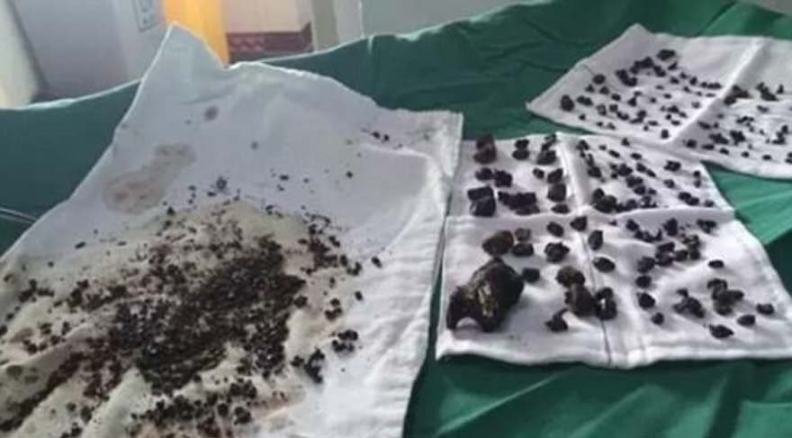 kadının vücudundan çıkanlar