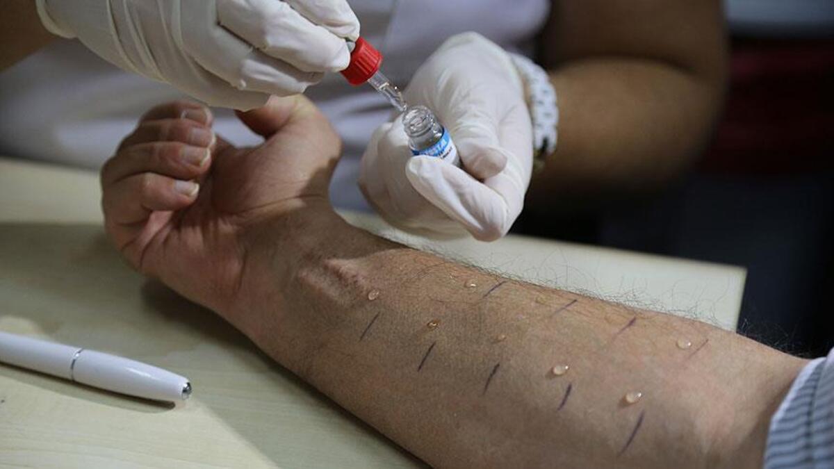 Alerji Neden Oluyor? » Pemmbe Alerji Neden Oluyor? » Pemmbe