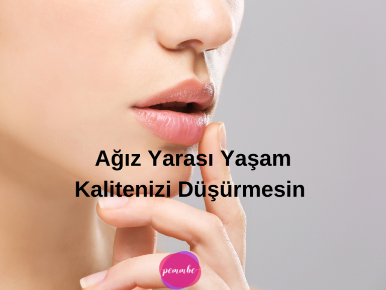 Ağız Yarası Yaşam Kalitenizi Düşürmesin