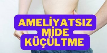 ameliyatsız mide küçültme