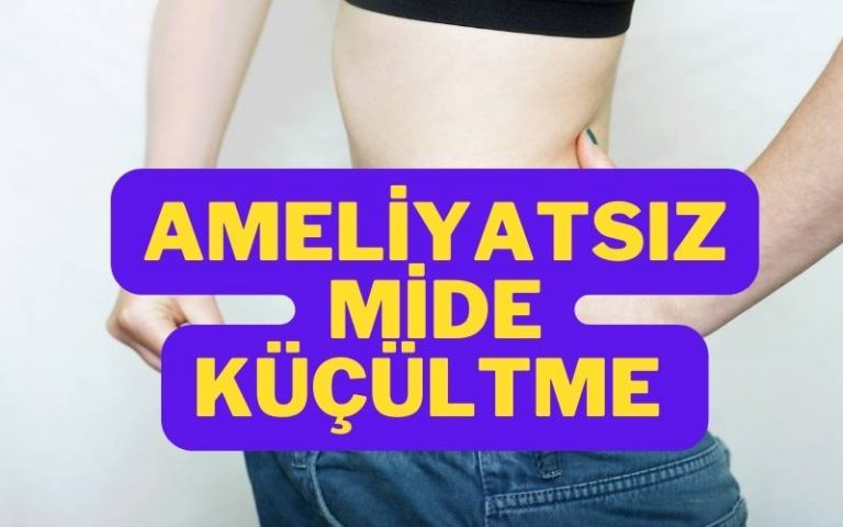 ameliyatsız mide küçültme